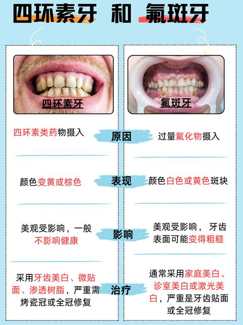 四环素牙美白，哪种方法更有效？-图2