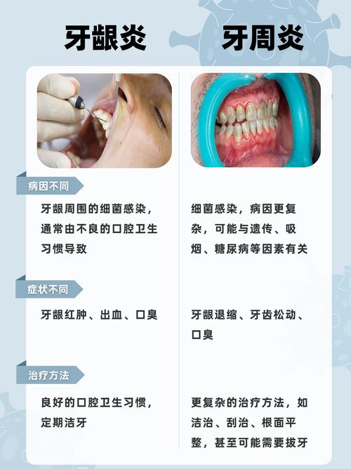 种牙后是否真的会诱发牙周炎？这些风险要了解-图2