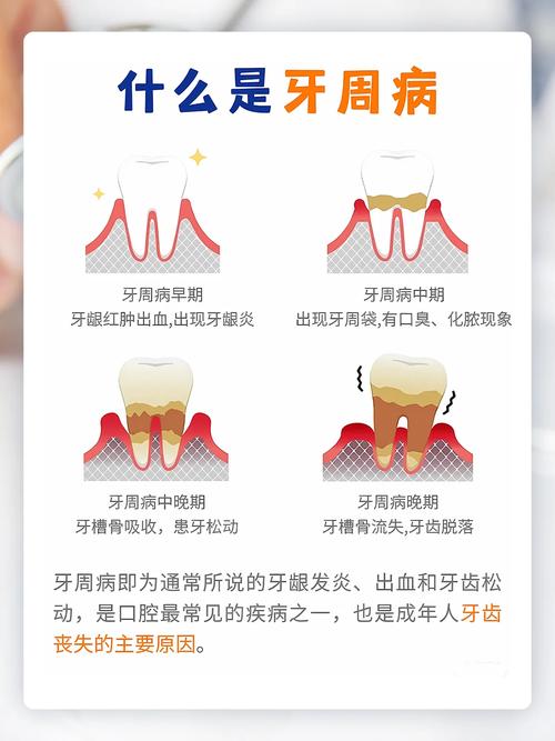 种牙后是否真的会诱发牙周炎？这些风险要了解-图1
