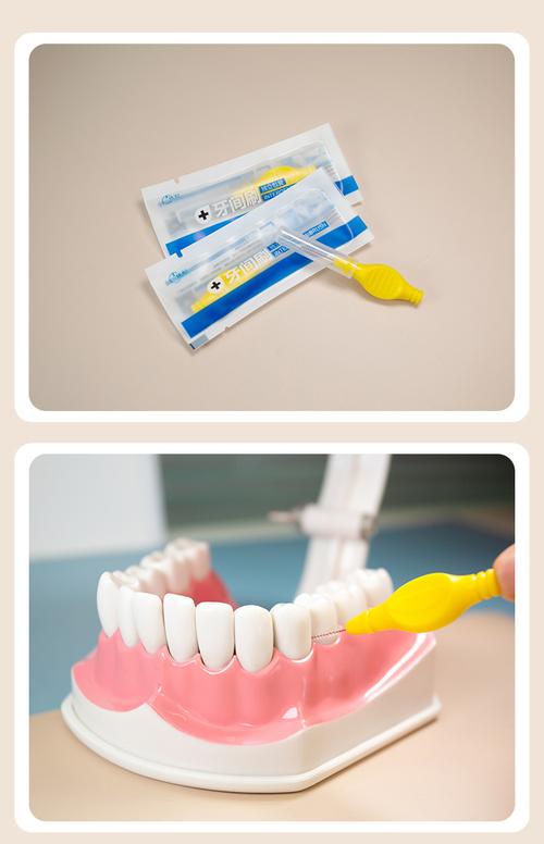 正畸刷牙必备工具有哪些?-图3 正畸刷牙必备工具有哪些?-图3