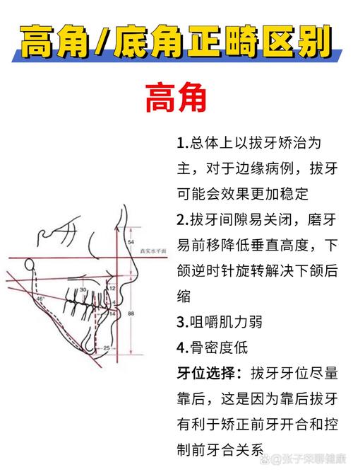 正畸牙弓宽度如何通过专业方法测量？-图1