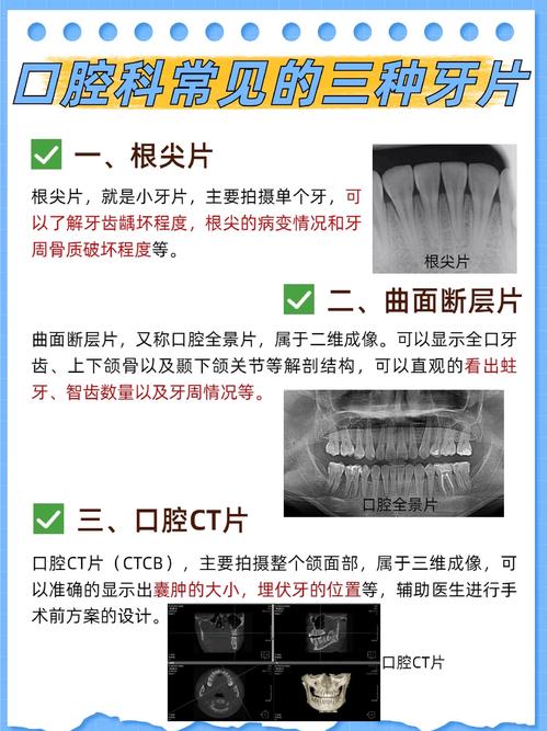 种牙CT测量数据，种植方案制定的关键依据有哪些？-图2