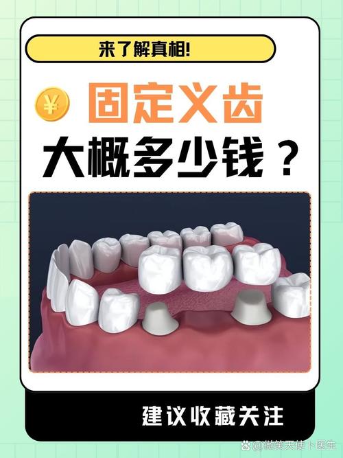 牙齿松动固定有哪些有效方法？-图3