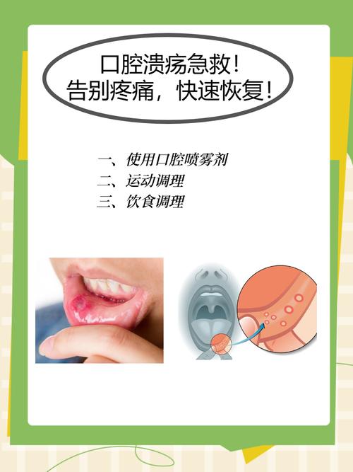 口腔炎有哪些有效的治疗方法及适用情况？-图2