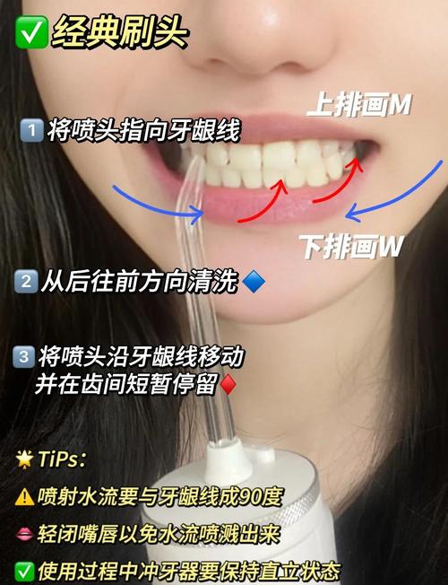 冲牙器正确使用方法有哪些关键步骤？-图2