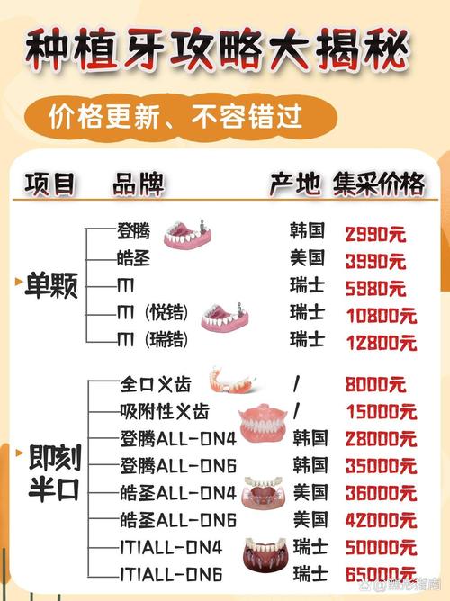 蛀牙即刻种牙的费用大概需要多少?-图3 蛀牙即刻种牙的费用大概需要多少?-图3
