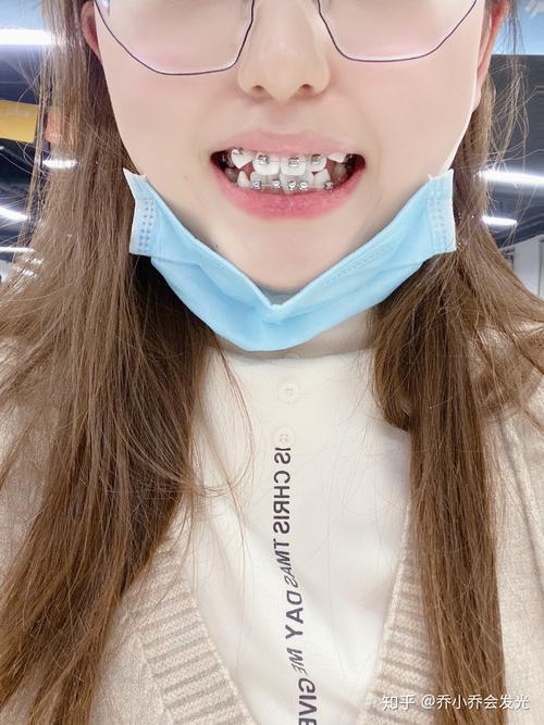 朝阳医院牙齿正畸挂号怎么预约？流程攻略-图3