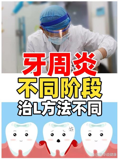 牙周病治疗方法有哪些？如何科学选择？-图3