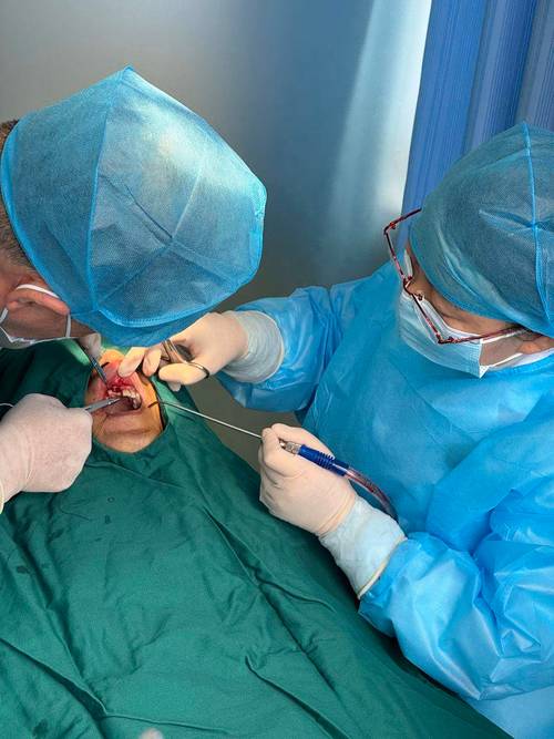 德国种牙技术视频能学到哪些技术亮点？-图1