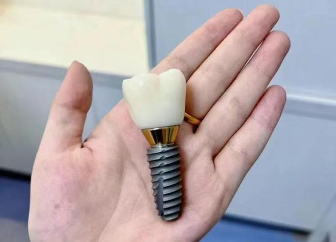 12000种植牙包含哪些项目？性价比如何？-图1