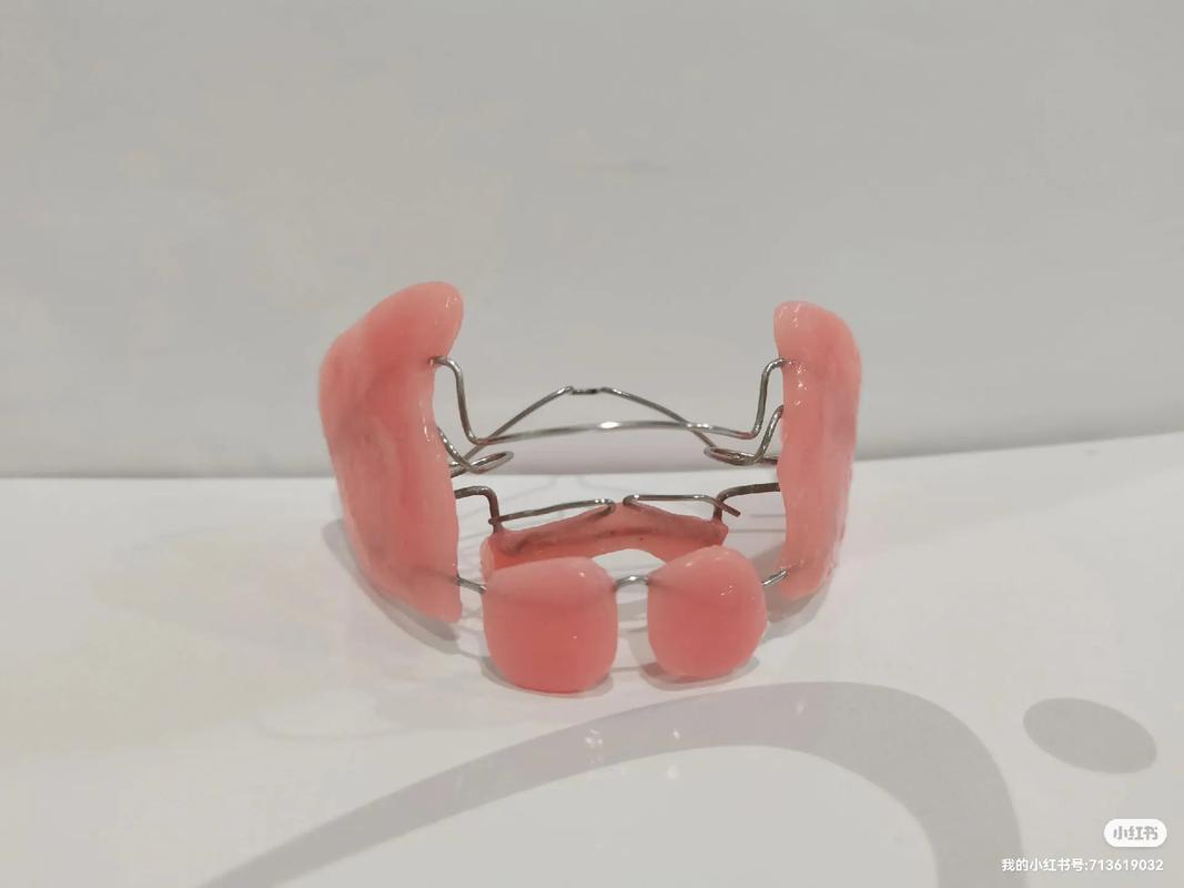 美国正畸协会为何强调儿童早期矫正的必要性？-图2