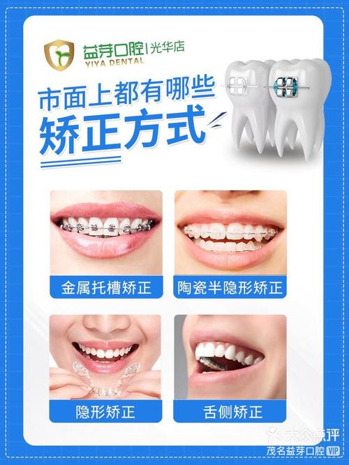 牙齿隐形正畸制作公司如何保障矫正效果？-图2