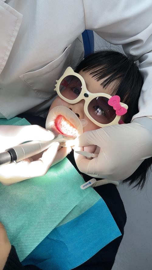 取牙模的方法有哪些？具体步骤及注意事项有哪些？-图2