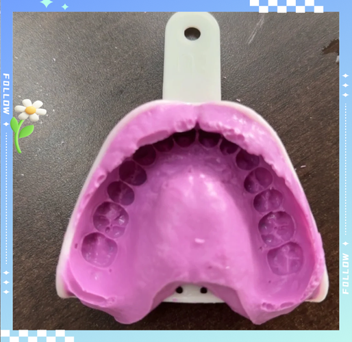 取牙模的方法有哪些？具体步骤及注意事项有哪些？-图1