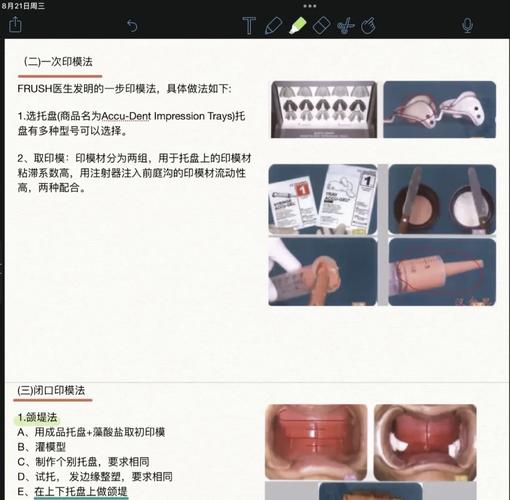 印牙模咬蜡方法的具体操作步骤有哪些？-图2