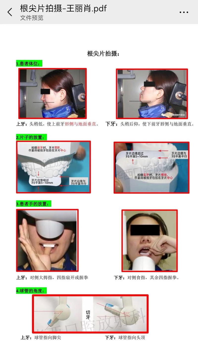 洗根片的具体步骤和注意事项有哪些？-图1