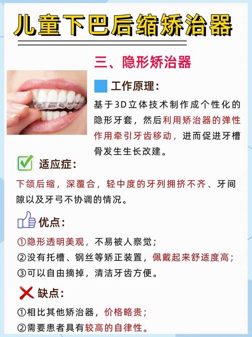 正畸附件粘结技术改进-图3