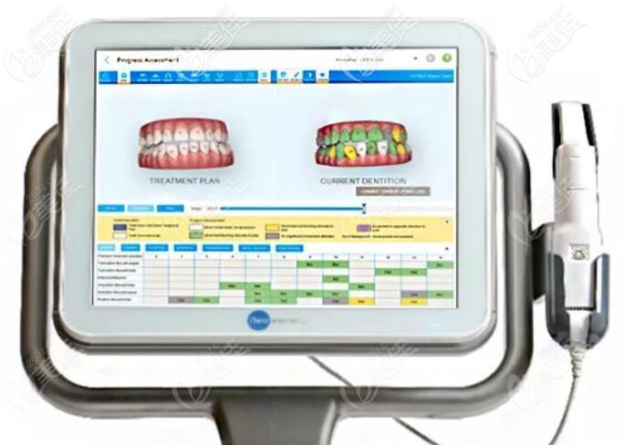 固定正畸复诊期间需监控哪些关键内容？-图1