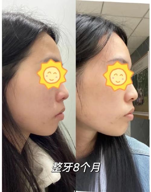 长沙美莱牙齿正畸效果好不好？值得信赖吗？-图1