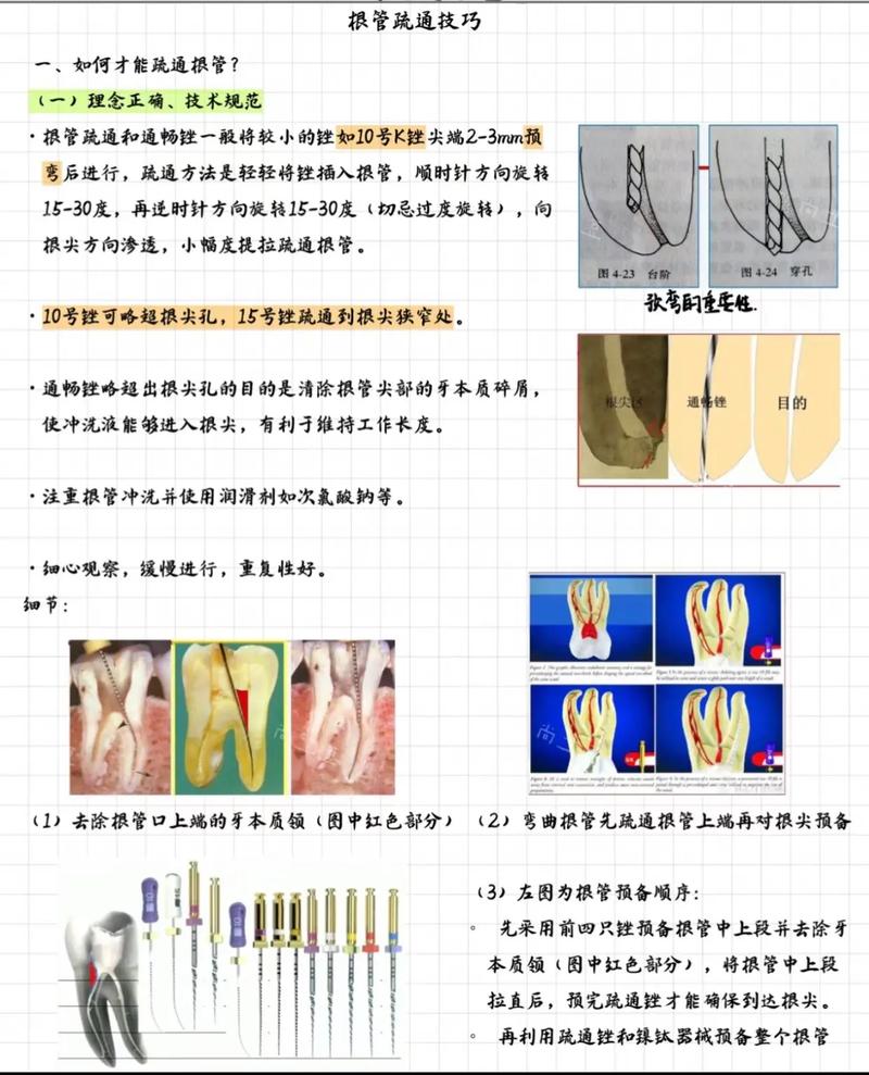 控根簧弯制方法的核心技巧是什么？-图3