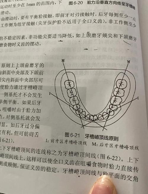 烤瓷牙排龈常用方法有哪些？如何正确操作？-图1