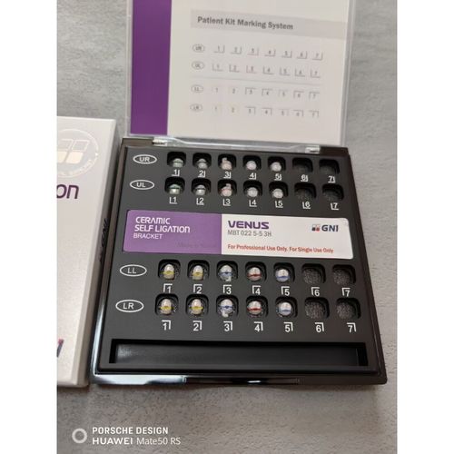 深圳正畸陶瓷托槽价格一般是多少？-图2