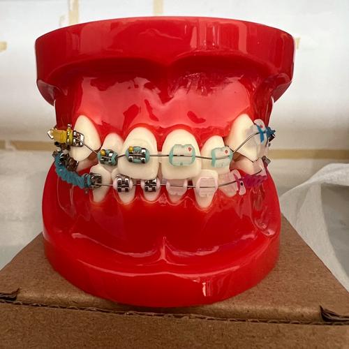 深圳正畸陶瓷托槽价格一般是多少？-图3