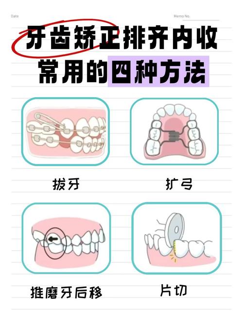 孩子牙齿不齐？小牙纠正方法有哪些？-图2