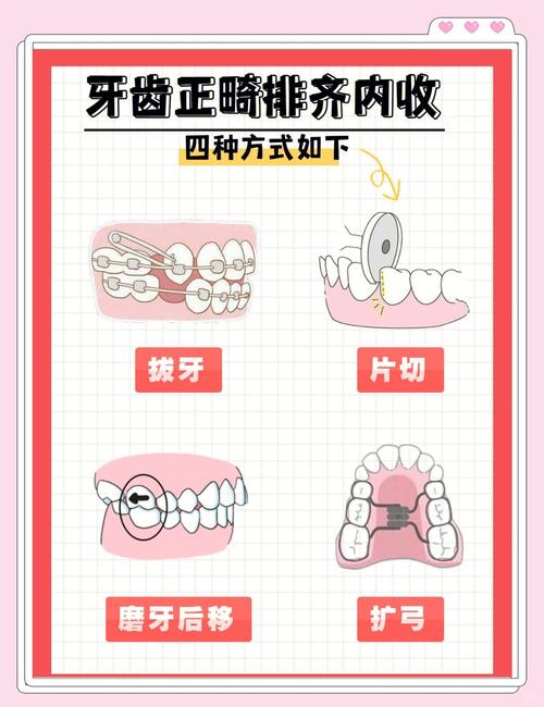 孩子牙齿不齐？小牙纠正方法有哪些？-图3