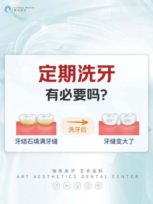 种牙期间能洗牙吗？医生提醒这几点要注意-图1