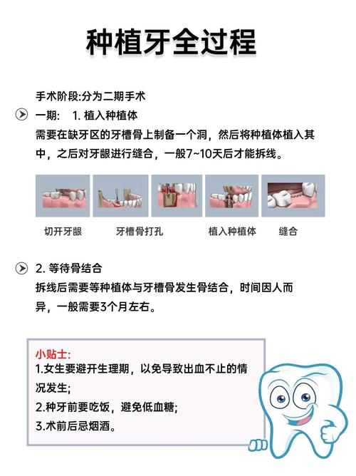 种植牙需要磨邻牙吗？邻牙会受影响吗？-图3