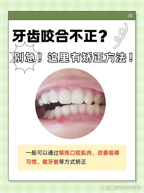 正畸打开咬合有哪些常用方法？哪种效果更好？-图2