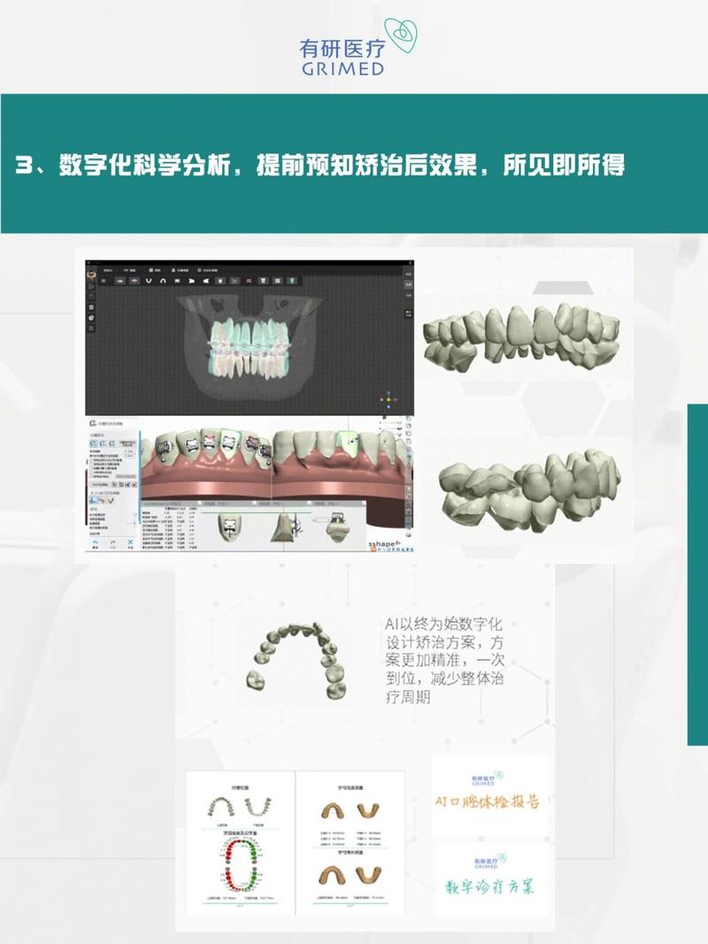 免费口腔正畸分析软件效果是否专业可靠？-图2