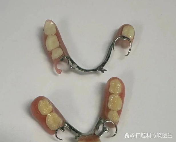 调隐形义齿时有哪些关键调整方法？-图3