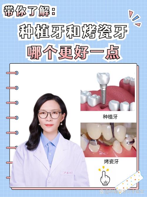 牙博士种植牙靠谱吗？效果真的值得信赖吗？-图3