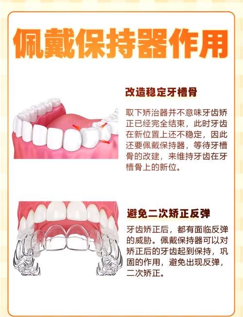保持器制作方法有哪些？自己动手的具体步骤是什么？-图2