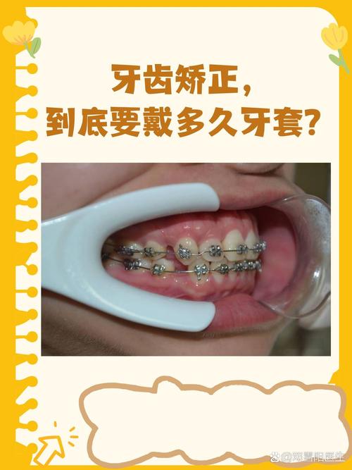 青岛牙齿正畸哪里最好？专业正畸机构怎么选？-图3