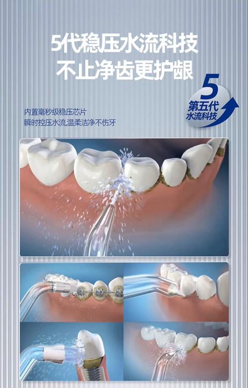 牙齿龋化后，究竟有哪些科学有效的修复方法？-图1