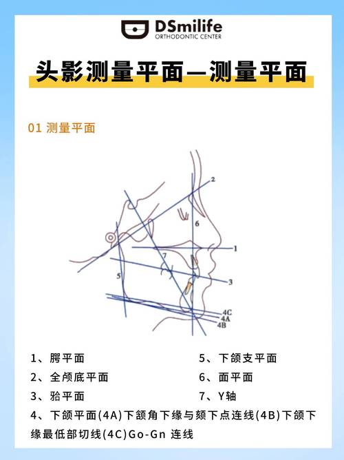 正畸头颅测量软件的正确使用方法有哪些？-图1