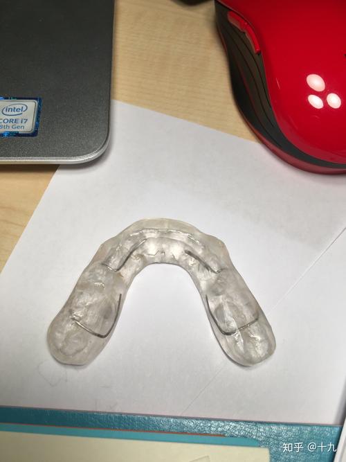 正畸牙齿咬合垫高图片能展示哪些变化？-图1