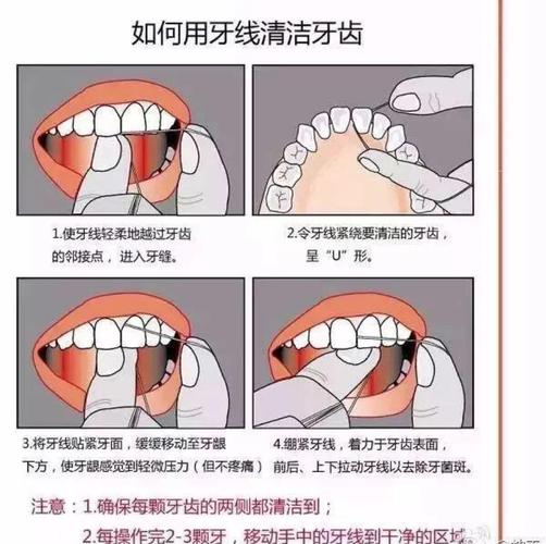 牙线正确操作的具体步骤和方法有哪些？-图1