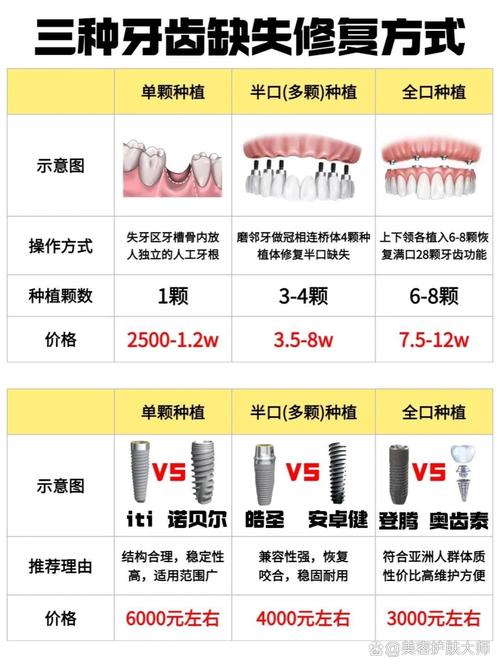 牙桥和种牙，到底哪种更适合你的牙齿情况？-图2