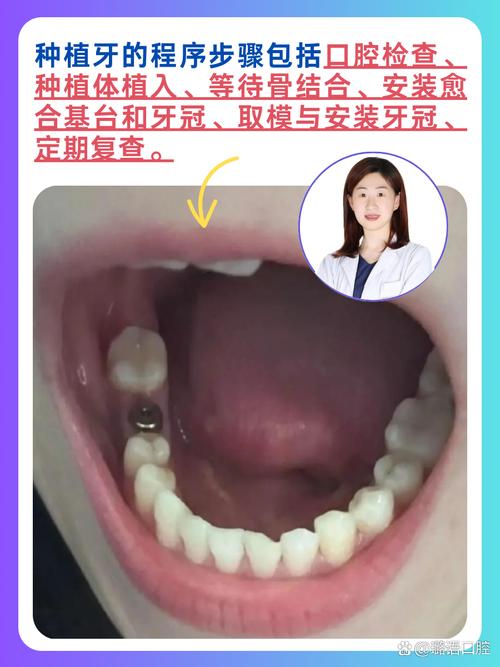 想知道种牙和箍牙，哪个治疗过程疼痛感更强？-图3