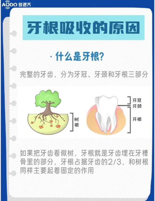 正畸治疗中如何有效防止牙根吸收？关键措施有哪些？-图1