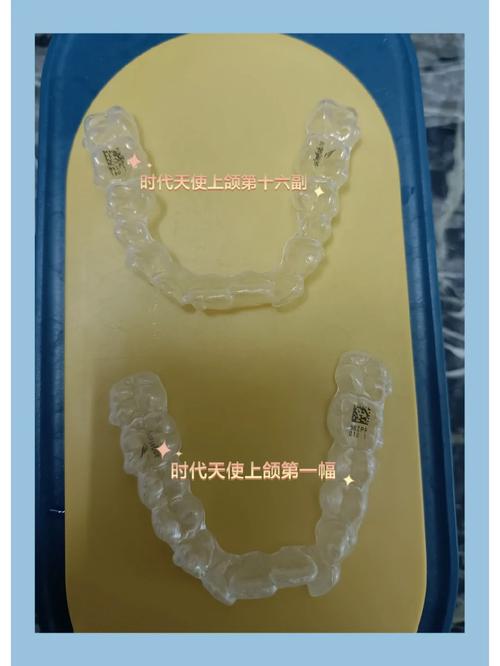 时代天使隐形正畸活动有哪些惊喜福利?-图3 时代天使隐形正畸活动有哪些惊喜福利?-图3