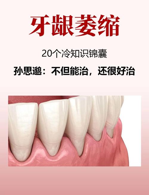 正畸过程中怎样科学有效预防牙龈萎缩？-图2