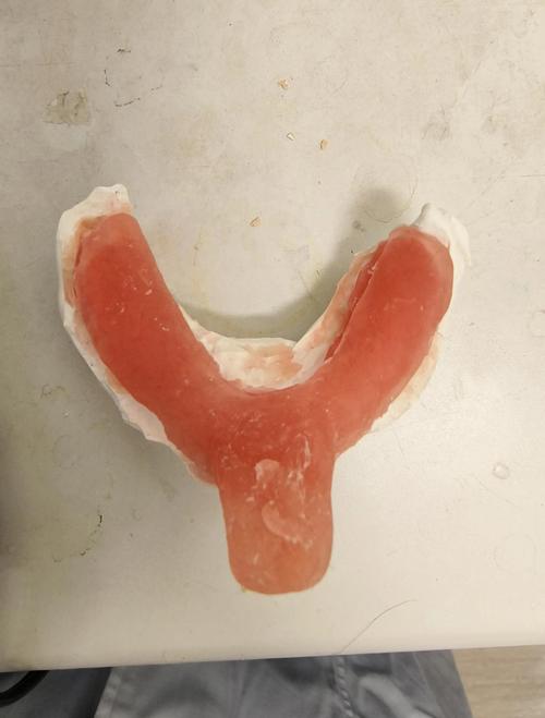 印模材使用需注意哪些关键步骤和要点？-图2