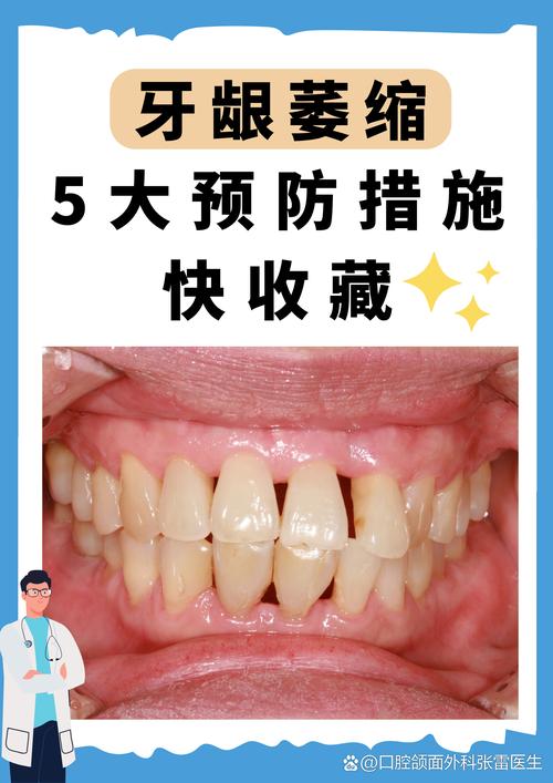 正畸后牙龈萎缩严重，如何有效处理？-图2