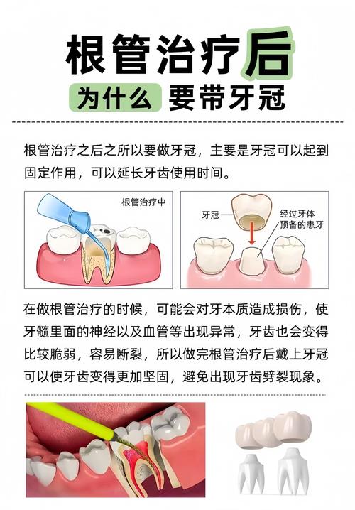 坏牙的处理方法-图1