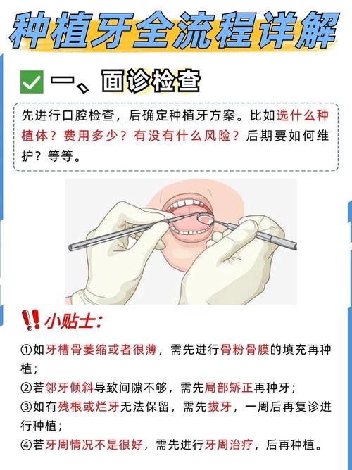 8020种牙计划是什么？适合哪些人群？-图2